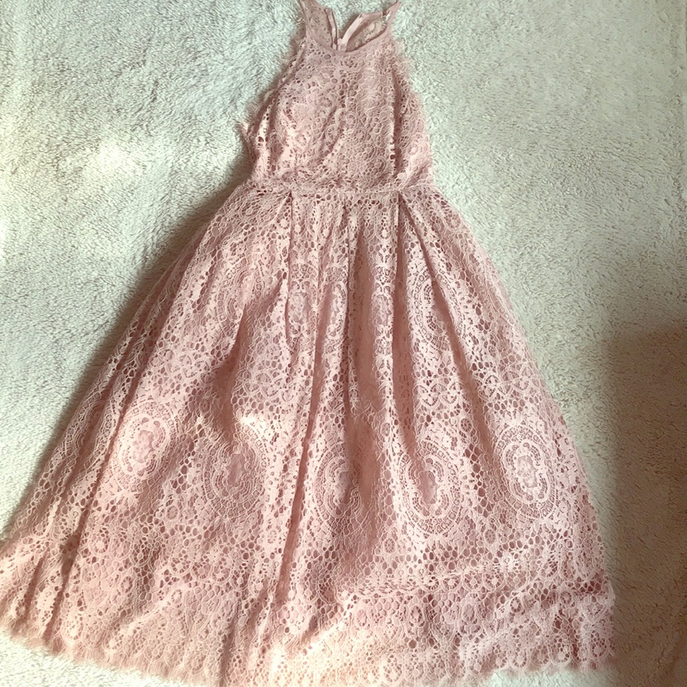 Lacy scalloped edge midi prom dress